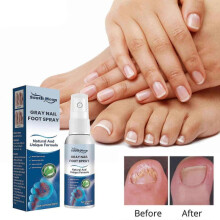 Antifungals Nail Treatments Spray In Medicals Quality, 30 Ml, Antifungals Nail Treatments, Antifungals Spray 30Ml