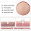 Microdarts Tag'gone Patch, Neutroera Blusoms Effortless Microdarts Tag-gone Patches 5