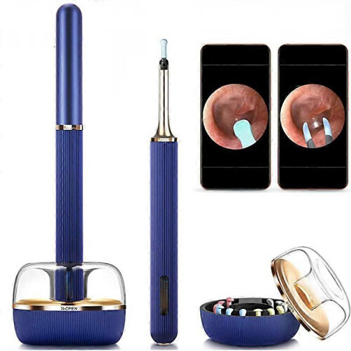 (Note3 PRO Blue)10 Megapixel HD Ear Wax Removal Endoscope Camera 2 in 1 Ear Cleaner 1