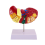 Liver Model for Common Pathologies, Human Anatomy Doctor Office 7