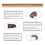 For Kenlin -Trak II Replacement-Drawer Rail Kit Part 168 for with Metal Back and Drawer Stops Rollers 2