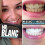 Mr. Blanc Teeth Whitening Strips 2 Week Supply 28 Strips Enamel Safe 5
