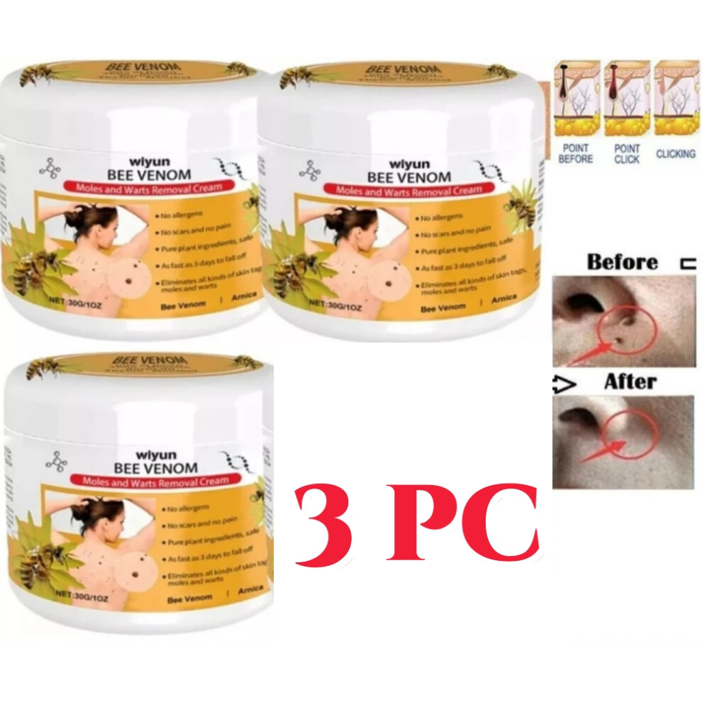 Cream 3Pc Bee Venom Wart Gentle Cleansing Skin Tags Meat Granules Kill Warts Moisturize And Smooth Skin