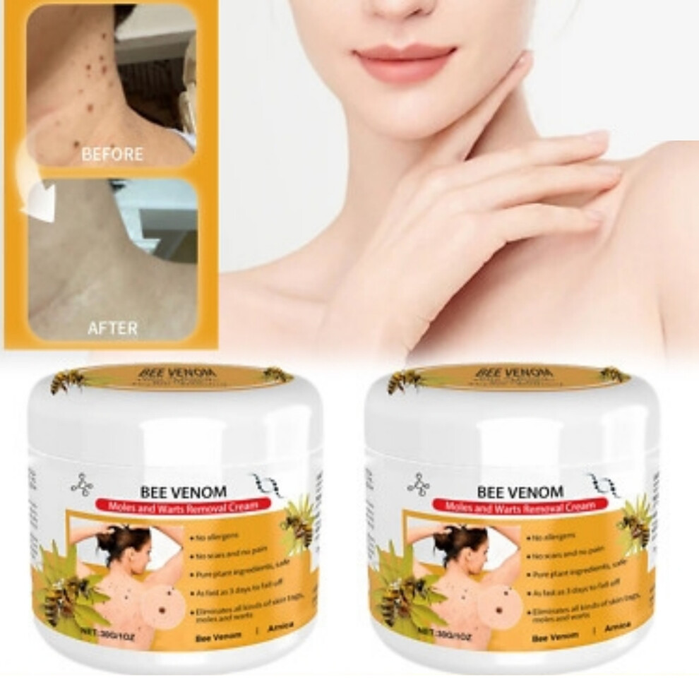 Cream 2Pc Bee Venom Wart Gentle Cleansing Skin Tags Meat Granules Kill Warts Moisturize And Smooth Skin