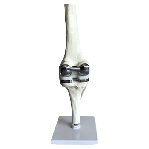 Knee Joint Model Simulation Replacement Surgery Meniscus Ligament Cartilages Model,Artificial 1