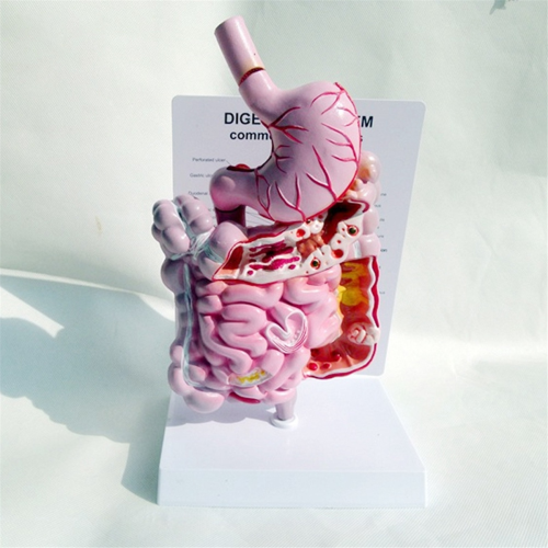 Human Digestive System Model Stomach Anatomy Intestine Cecum Rectum Duodenum Internal Organs Structure 2