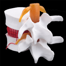 Human Anatomy Skeleton Spine Lumbar Disc Herniation Teaching Model Brain Skull Traumatic School Supplies Instrume