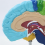 Right Hemisphere of Brain Human Body Model Education 1:1 for Student Teaching Study Assembling 8