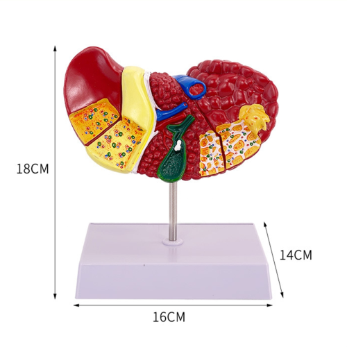 Liver Model for Common Pathologies, Human Anatomy Doctor Office 2