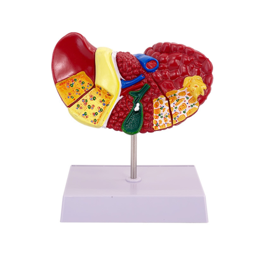 Liver Model for Common Pathologies, Human Anatomy Doctor Office 1