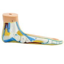 Voetanatomiemodel, menselijk normaal plat gebogen spiermodel voeten (platvoet)