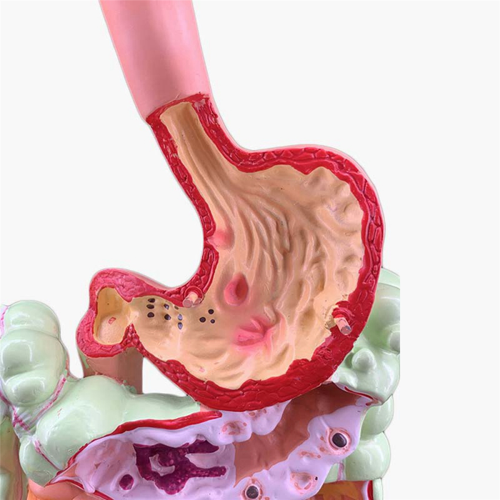 Human Digestive System Model Stomach Anatomy Large Intestine Cecum 2