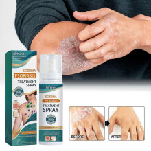 (2pcs) Eczema Psoriasis Treatment Spray, Herbal Psoriasis Relief Spray Eczema Relief Spray Vitiligo Psoriasis Treatment Relief Spray Skin Repair Spray