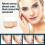 Gel Therapy for C-section Keloid, Injury, Burns, And --i 2