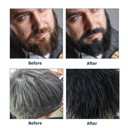 3X Permanent Beard Dye Shampoo for Men Beard Dying Removal Hair 200ML 2