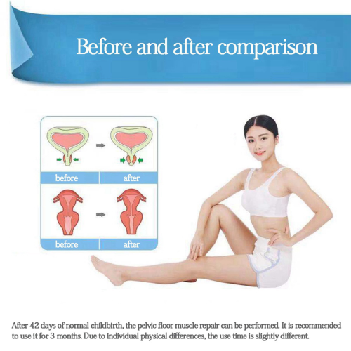 Vaginal sondelektroder TENS/EMS Bäckenbottenmuskelstimulator 1