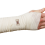 50 st elastiska bandage för stretch av metallklämmor 2