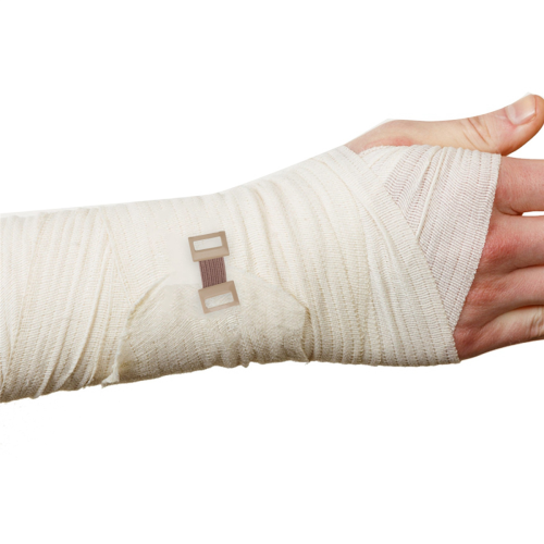 50 st elastiska bandage för stretch av metallklämmor 1