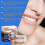 Silicone Relinedenture Set, Denture Reline Kit, Denture Set 5