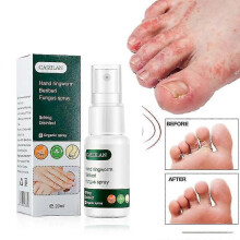 (3pcs) Hand And Foot Skin Spray Hand And Foot Spray Suitable For Dry, Cracked And Flaky Skin