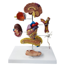 Modelset voor diabetes type II, voor onderwijs in menselijke anatomie en fysiologie, anatomische modellen voor de dokterspraktijk