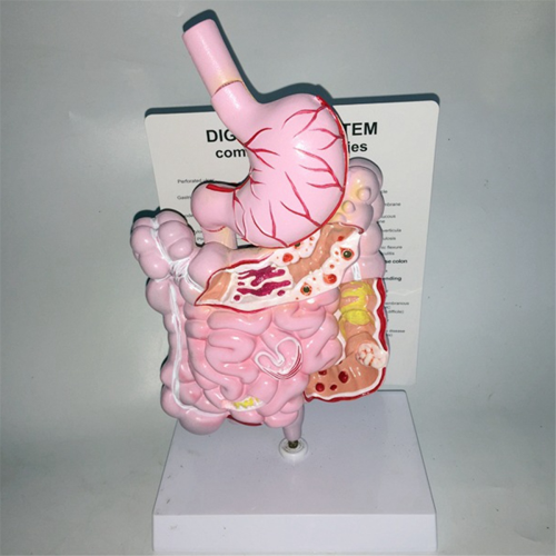 Model van het menselijk spijsverteringsstelsel Maag Anatomie Darm Blindedarm Rectum Duodenum Interne organen Structuur 2