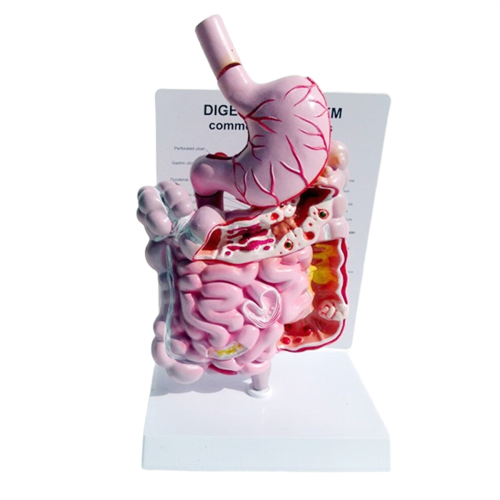 Model van het menselijk spijsverteringsstelsel Maag Anatomie Darm Blindedarm Rectum Duodenum Interne organen Structuur
