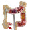Pathologisch colorectaal model dikke darm gastro-intestinaal anatomisch 6