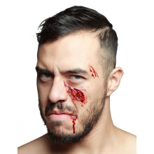 Fake sunken cheekbone injury