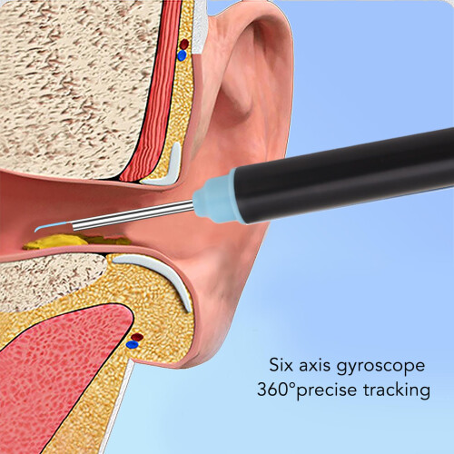 Smart Ear Cleaner Tool 2MP Camera LED Lights 360 Visual Aid 2