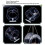 Wild Bird Feeder Clear Round Shape with Strong Suction Cups for Garden Use 4