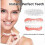 (1pc) Advanced Customized Full Denture Set, Silicone Reline Denture Set 4