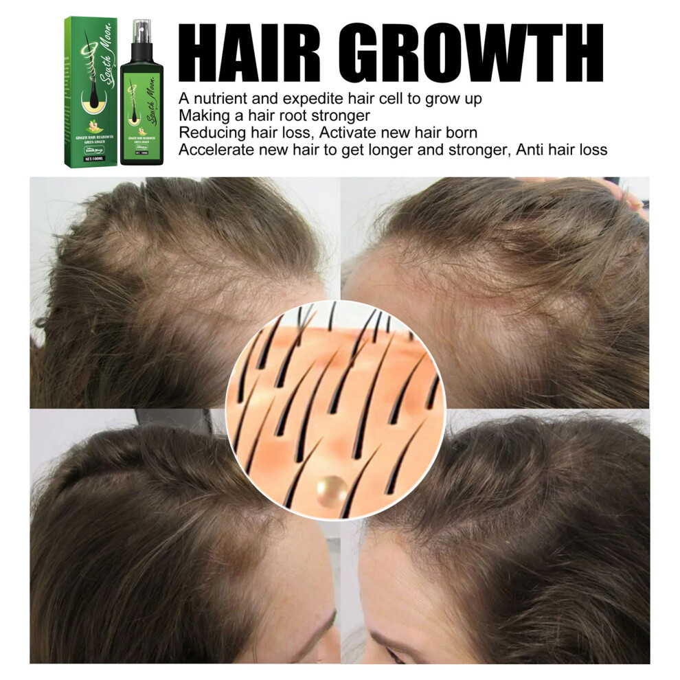 Hydrating Hair Growth Spray 100ml Thickening & Moisturizing Treatment