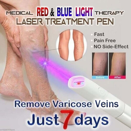 Stylo anti-varices 172*65*38mm AAA 2