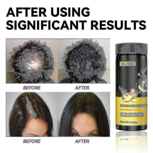 Anti-breakage Ginger Care Ca -w 2