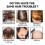 Anti-breakage Ginger Care Ca -w 4