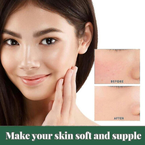 Gel Mask --d 1