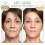 Gel Mask --d 4