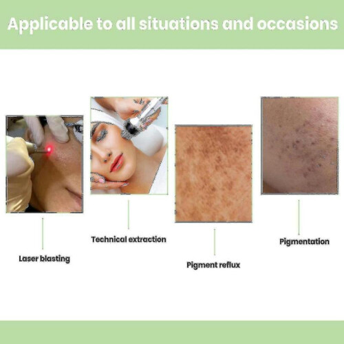 Lightening Cream Lightening Melasma, -b 2