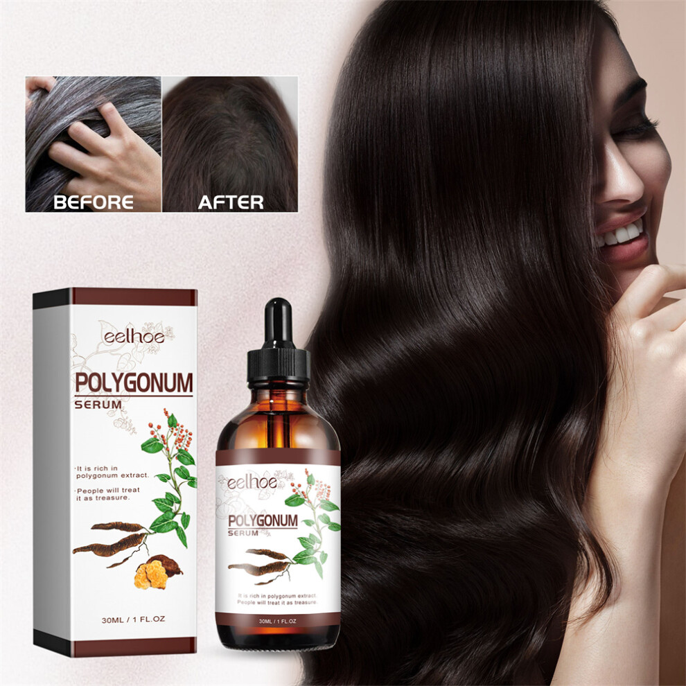 5PC Polygonum Multiflorum Oil Control, Anti-dandruff, Anti-itch, Anti-hair Loss Serum