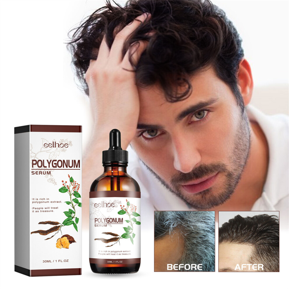 3PC Polygonum Multiflorum Oil Control, Anti-dandruff, Anti-itch, Anti-hair Loss Serum
