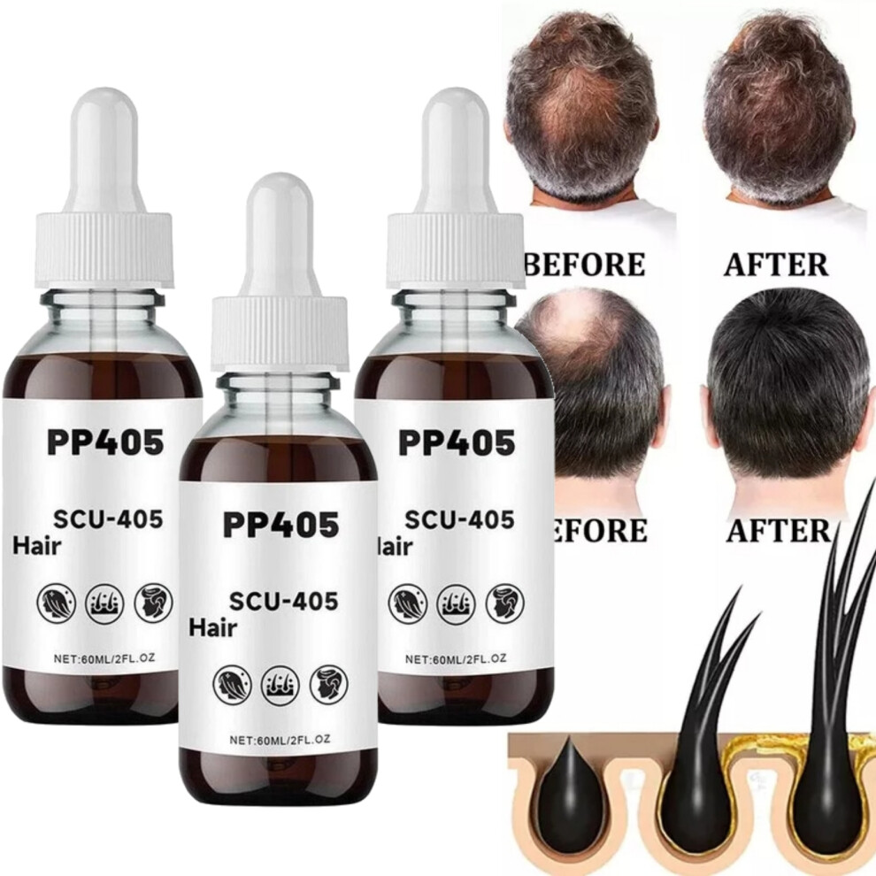 3PC PP405 Hair Care Anti-Hair Loss Fast Absorbing and Non-Greasy Hair Growth 60ml