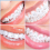 Kit de joias com cristais para dentes DIY 3