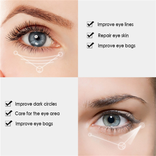 Creme para os olhos com nicotinamida remove olheiras e bolsas sob os olhos 2