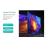 Display Module -Compatible Splitter 1 in 2 Set-Top Box PS Host Notebook Out Monitor 10