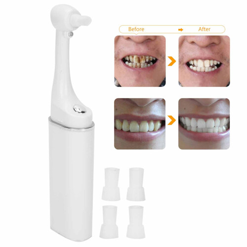 Effective 4-Head Tooth Polisher Tartar Plaque
