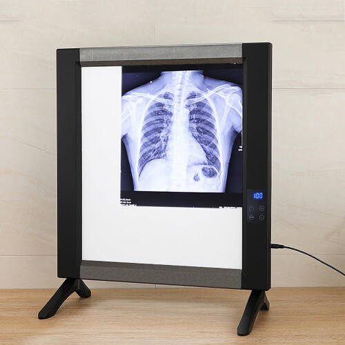 X-ray LED Board Box TPC Slide Viewer Illuminator 4 mm Optical Acrylic Diffuser 4500 cd/m2 Lighting For Hospital