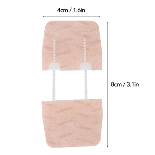 Pansement de fermeture de plaie 48 cm, 1,63,1 po, 2 boucles 1