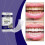 (2packs) Teeth Whitening Strips, Safe And Rapid Teeth Whitening Strips, Sensitive Teeth Whitening Strips 2