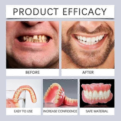 (2pcs)1/2/3x Advanced Customized Full Denture Set, Silicone Reline Denture Set 2